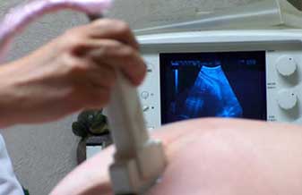 Cláudio A. M. Casarini - Foto 1