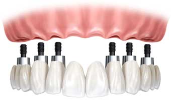 Laboratório Prótese Amadei - Foto 1